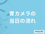 「胃カメラ当日の流れ」はご存じですか？注意点や発見できる病気を医師が解説！