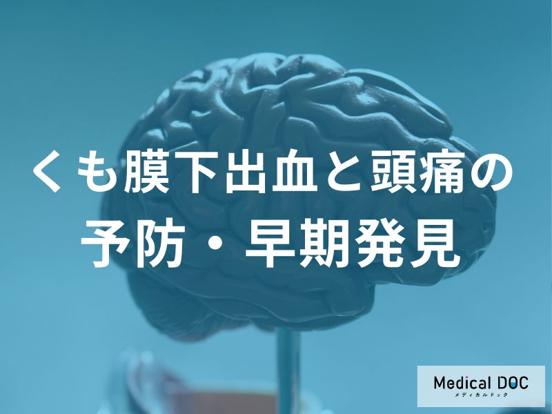 「くも膜下出血の警告頭痛」を医師が解説 前兆を見逃さないためのポイントとは