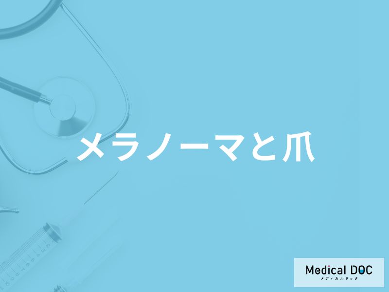 「メラノーマ」を発症すると「爪の形や色」はどのように変化する？【医師解説】