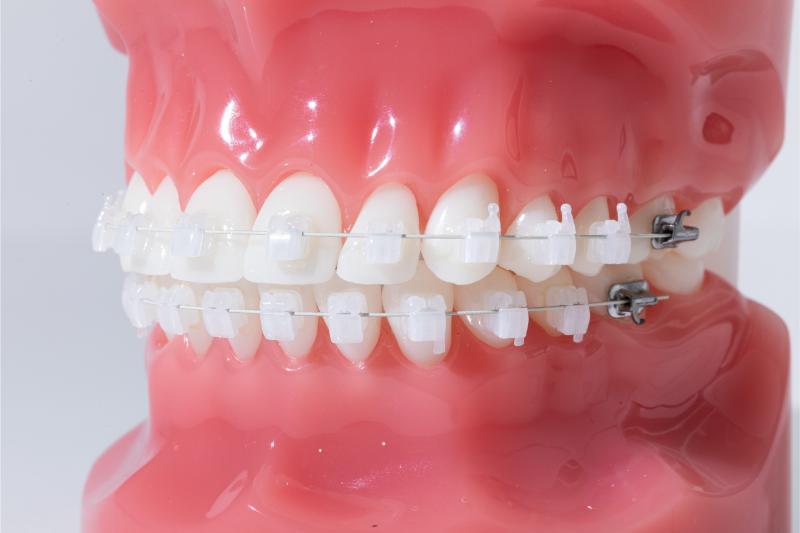 中野駅ウエスト矯正歯科