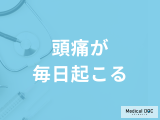 「頭痛が毎日起きる」原因は何かご存じですか？考えられる病気を医師が解説！