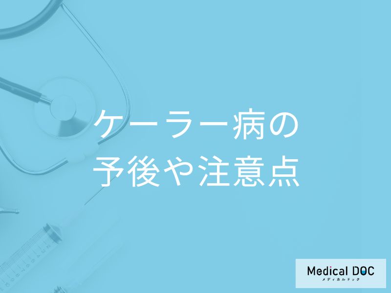 「ケーラー病」は放置すると後遺症が残るのか？予後と周囲のサポート法も医師が解説！