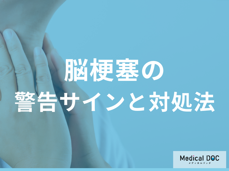 「脳梗塞」は時間との勝負! 見逃してはいけない警告サインと対処法【医師解説】