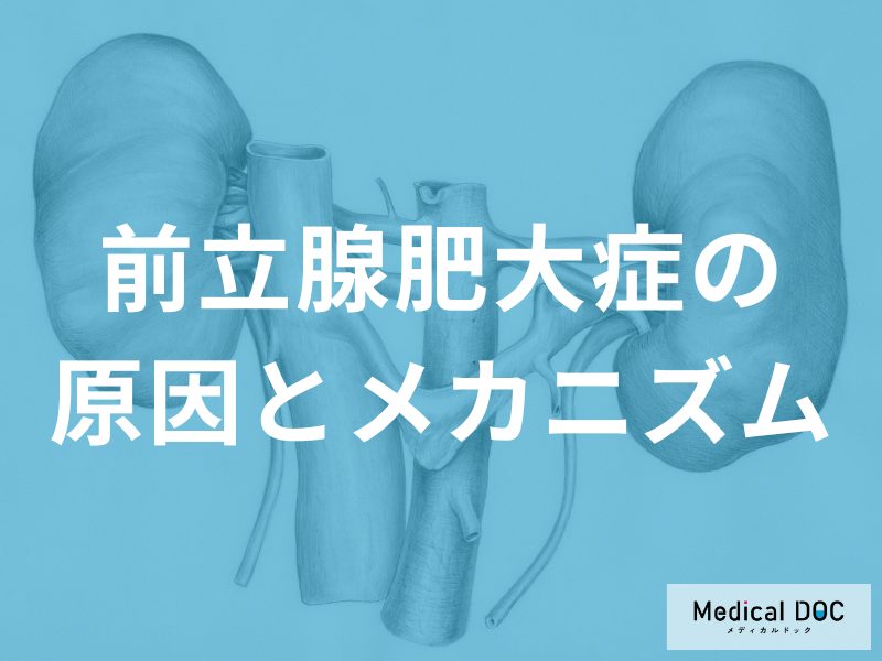 「前立腺肥大症」の発症リスクが“4倍高い人”とは? 『加齢』との関係も医師が解説