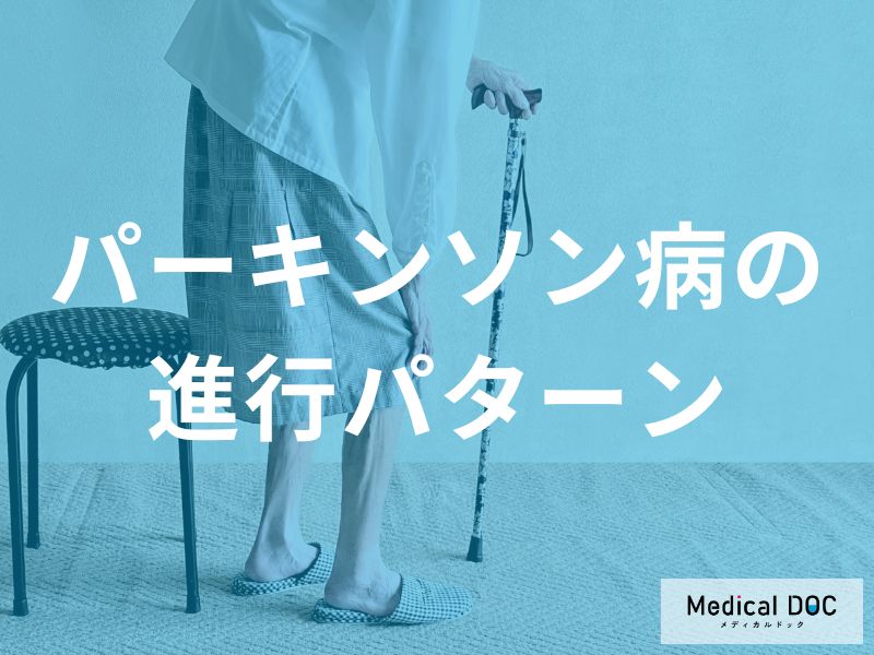 パーキンソン病の進行パターンと個人差