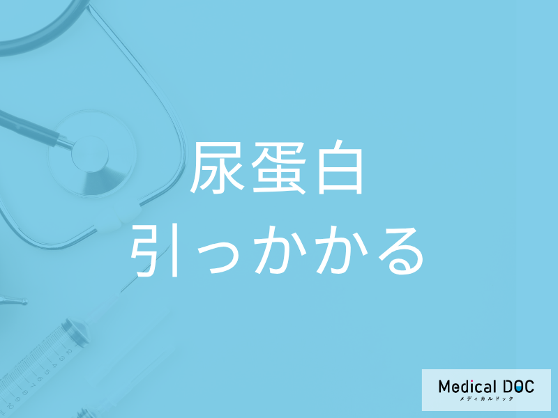 【尿検査】実際、朝一番と2回目の尿で検査結果は変わる? 「尿蛋白」の影響を医師が解説