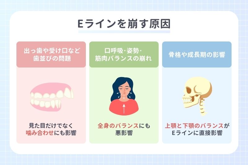 Eラインを崩す原因