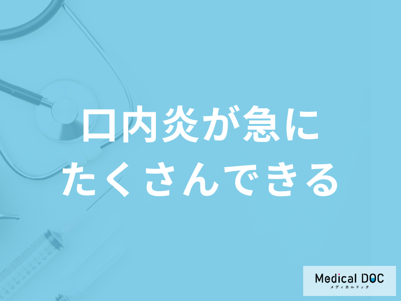 「口内炎が急にたくさんできる」のはがんの可能性がある?考えられる病気を医師が解説!