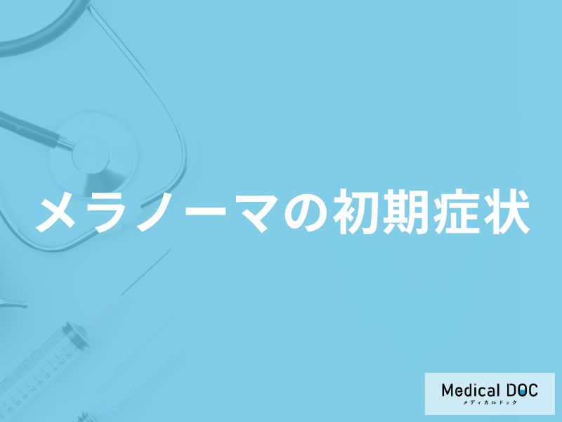 「メラノーマ」の初期症状はご存知ですか？【医師解説】