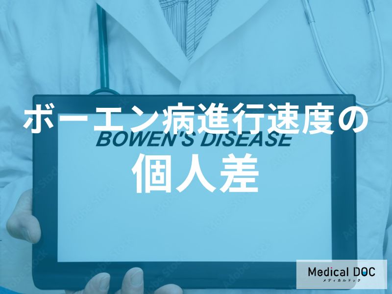 「ボーエン病進行速度に個人差」はあるのか？要因を解説！【医師監修】