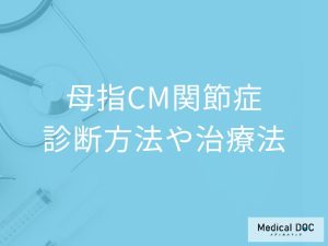 母指CM関節症の診断方法、治療法とは？