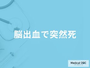 「脳出血で突然死」する前兆症状はご存知ですか？突然死する原因も医師が解説！