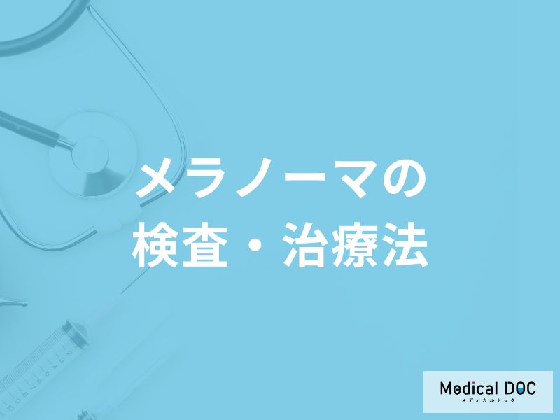 「メラノーマ」の検査・治療法はご存知ですか？【医師解説】