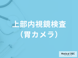 「上部内視鏡検査（胃カメラ）」とは？合併症が起きる確率はどのくらい？医師が解説！