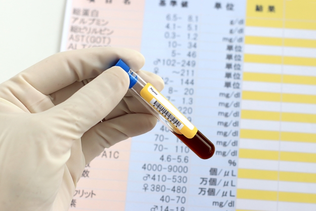 梅毒で唇に症状が出たときの対処法と治療法