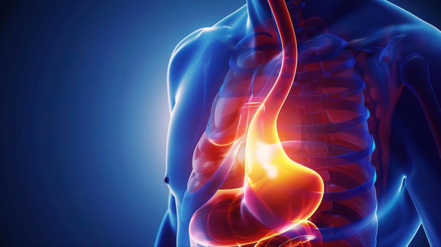 逆流性食道炎とは