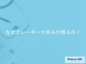 なぜクレーターや赤みが残るの？