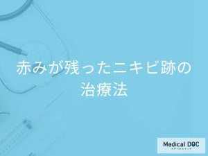 赤みが残ったニキビ跡の治療法