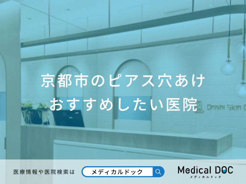 京都市のピアス穴あけおすすめしたい医院