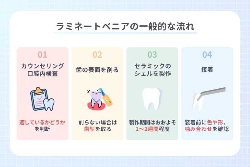 ラミネートベニアの一般的な流れ