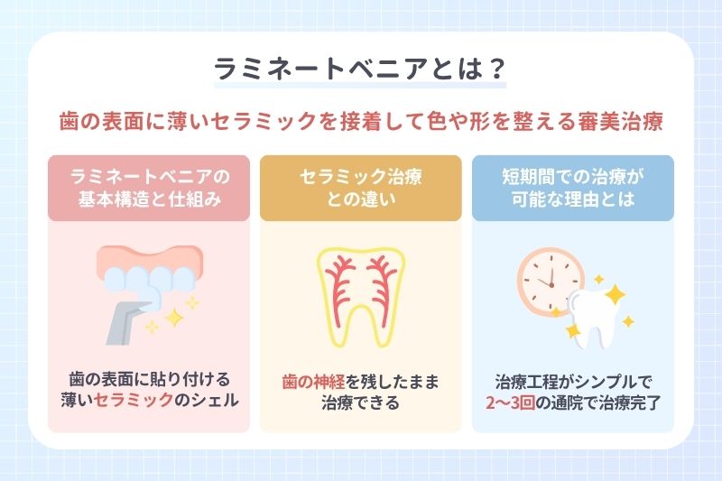 ラミネートベニアとは？