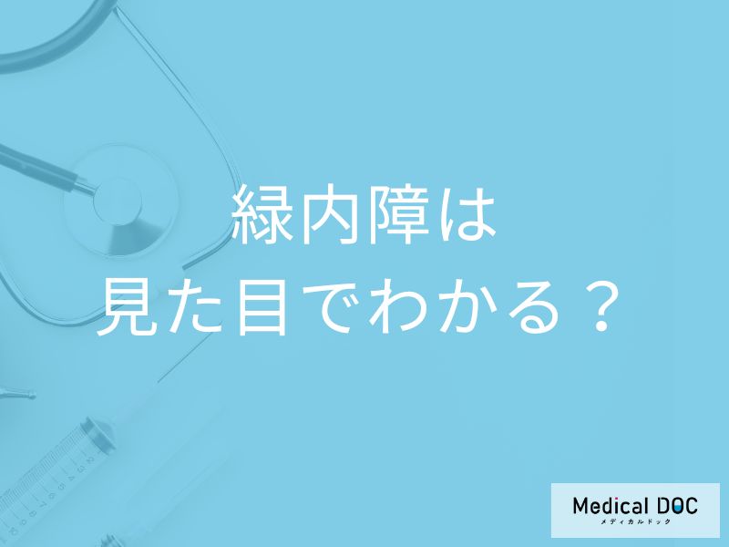 「緑内障」かどうか「見た目」でわかるの？自覚症状や緑内障の見え方も解説！