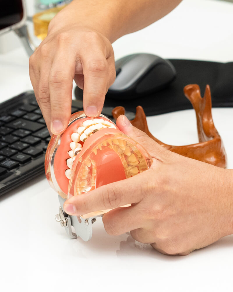 インプラント治療とは? 知っておきたい治療とポイント