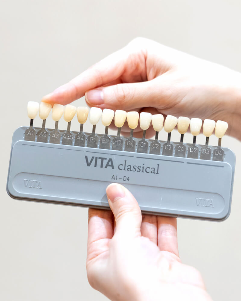 定期的なクリーニングが歯の白さキープのカギ