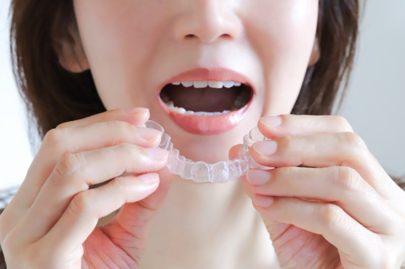 マウスピースを口に入れる