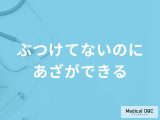 非公開: 「ぶつけてないのにあざができる」原因はご存知ですか？医師が徹底解説！