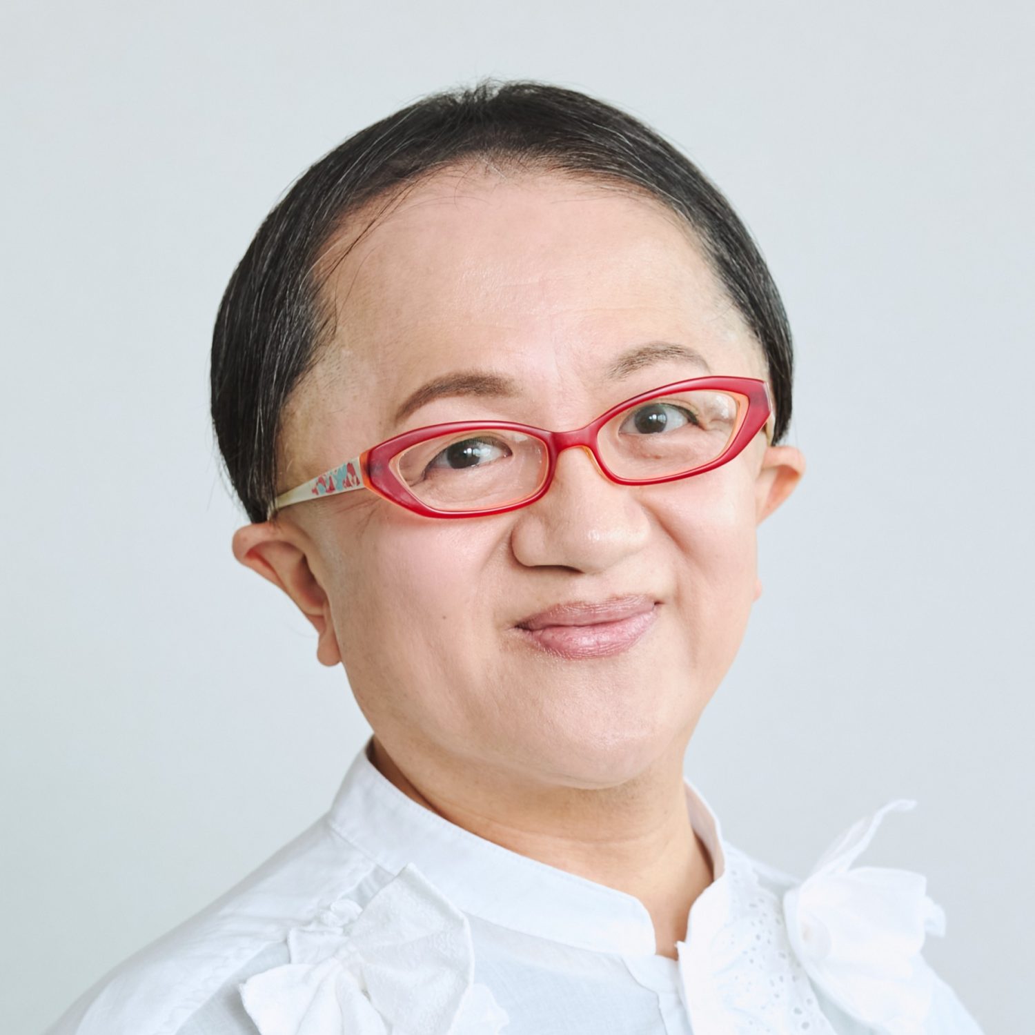 米良美一「くも膜下出血」後遺症で2度も死の淵に。奇跡の復帰までの壮絶闘病とは