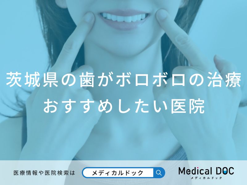 茨城県の歯がボロボロの治療 おすすめしたい医院