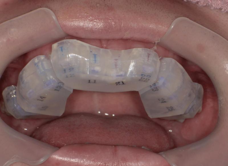 こじま矯正歯科クリニック