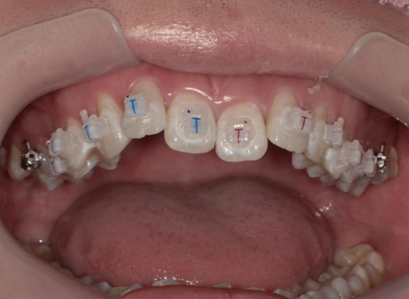 こじま矯正歯科クリニック