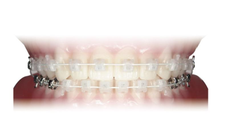 こじま矯正歯科クリニック