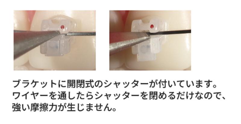 こじま矯正歯科クリニック