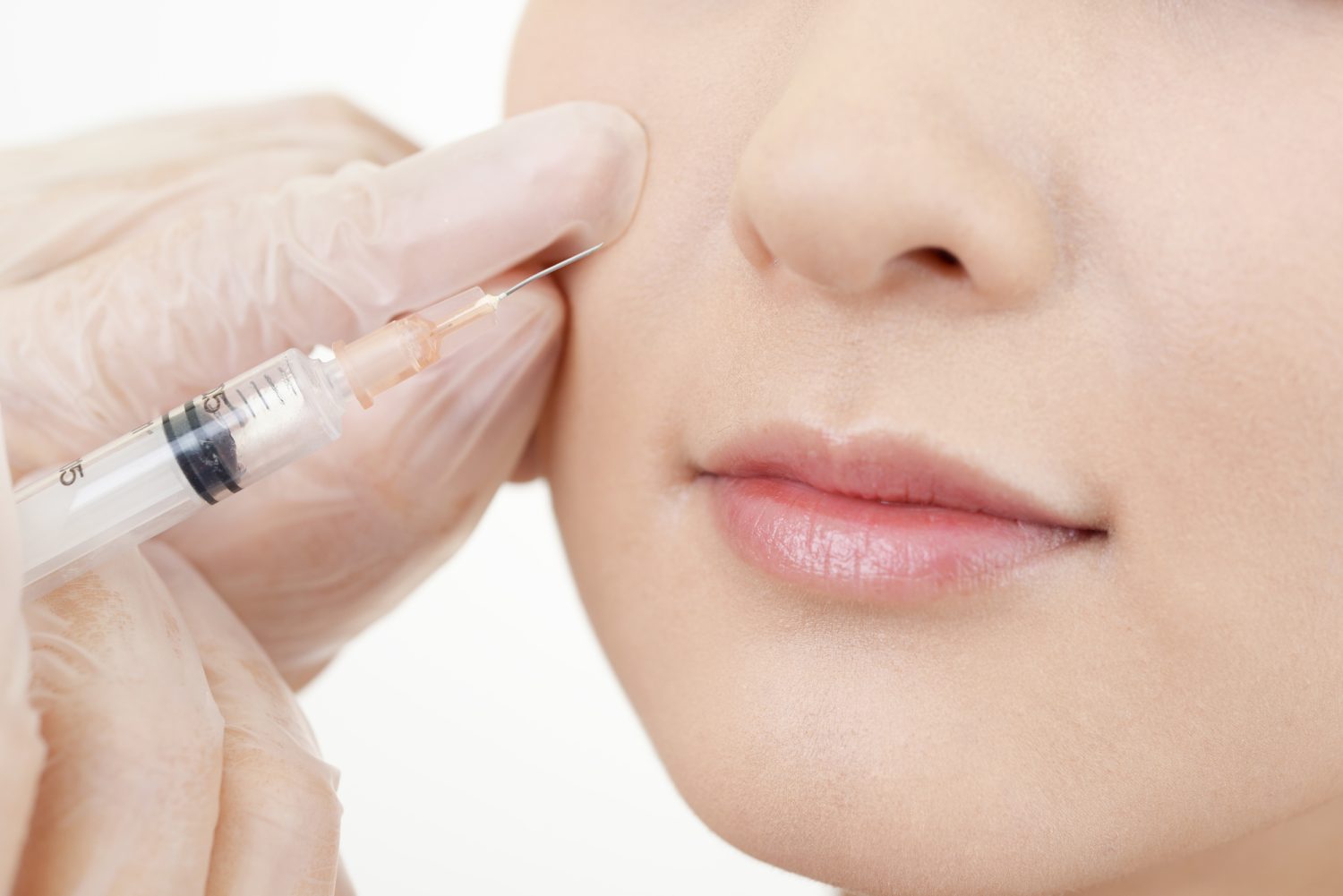 骨を補うためのヒアルロン酸注入の仕組みとは