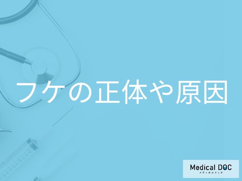 フケの正体や原因って？ 医師が解説！