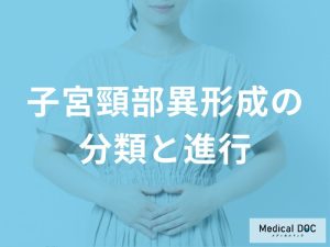 子宮頸部異形成の分類と進行について