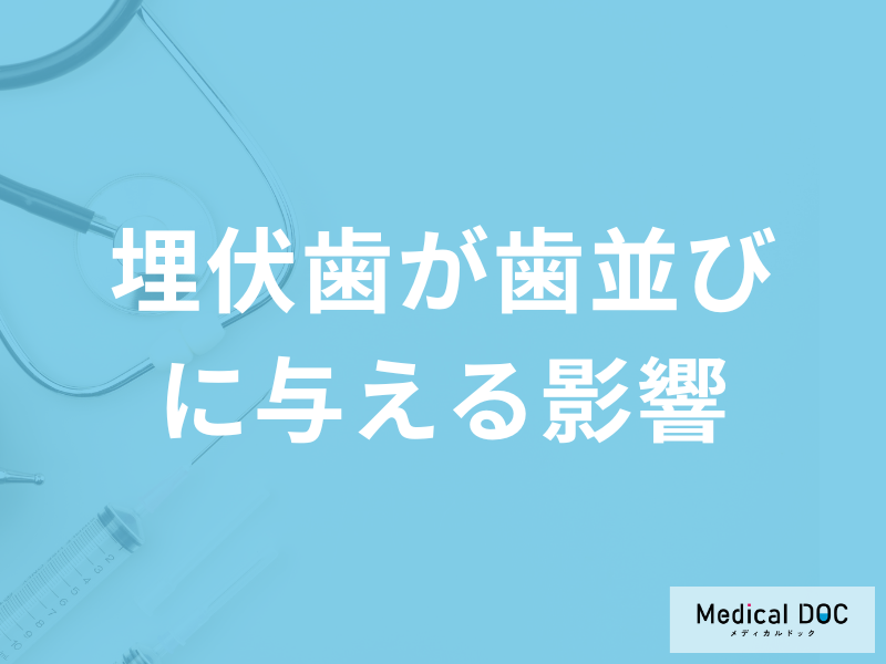「埋伏歯が歯並びにどのような影響を与える」のかご存じですか？医師が解説！