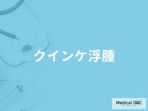 突然手足などが腫れる「クインケ浮腫」を放置するとどうなる？【医師監修】