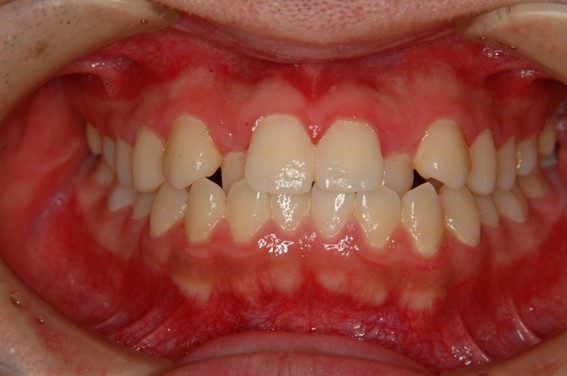 天神AN矯正歯科