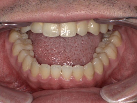 天神AN矯正歯科