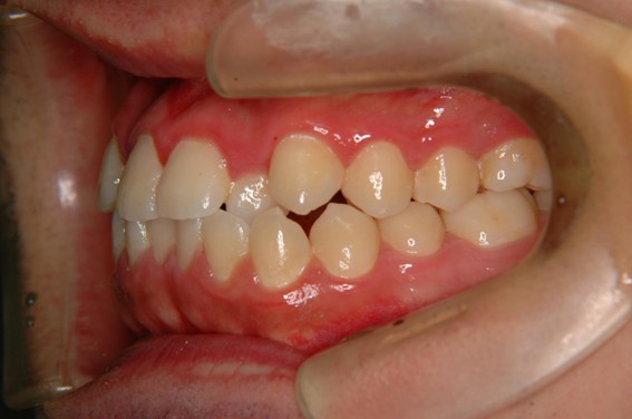 天神AN矯正歯科