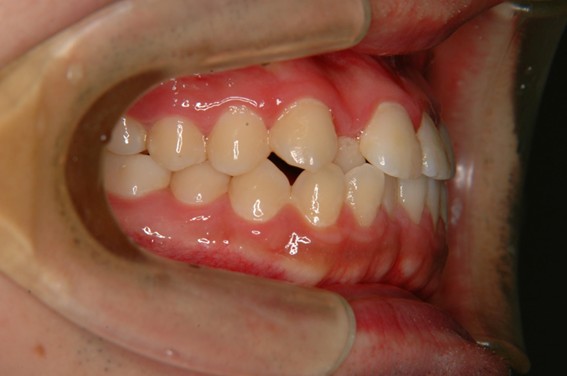 天神AN矯正歯科