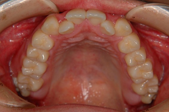 天神AN矯正歯科