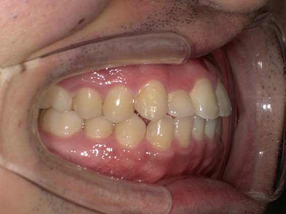 天神AN矯正歯科