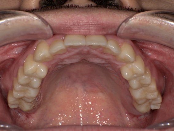 天神AN矯正歯科