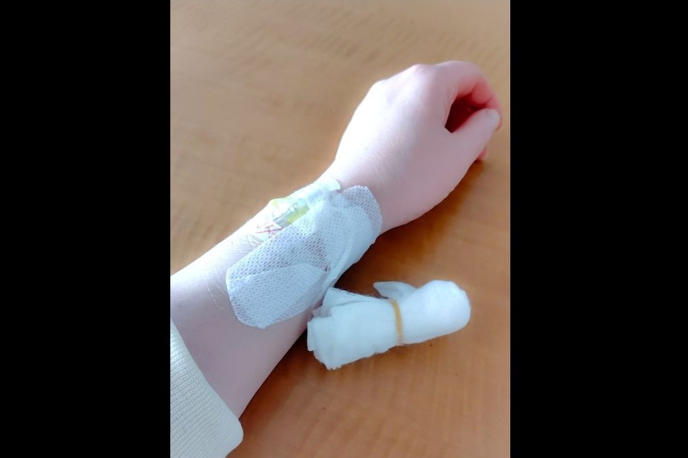 混合性結合組織病治療