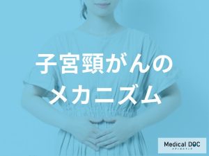 子宮頸がんの基本的な特徴と発生メカニズム